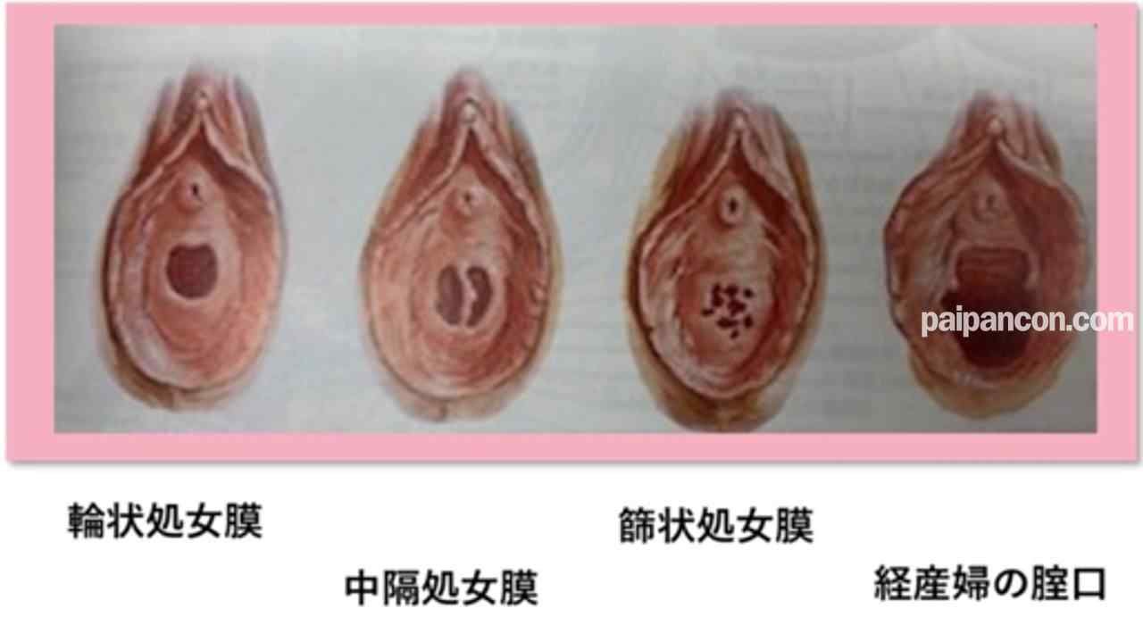 FC2-PPV-2880061 - 純白、『**』『ファーストキス』、、正真正銘の本物の****の瞬間！卒業式から１５日後、１８才！あの偏差値７５の国立の超名門大学合格天才、個撮２３２人目 thumbnail_9.jpg